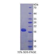 SDS-PAGE analysis of recombinant Mouse Ficolin 2 (FCN2) Protein.