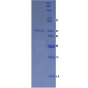 SDS-PAGE analysis of Human Filaggrin Protein.