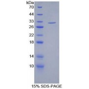 SDS-PAGE analysis of recombinant Human Filamin C gamma Protein.