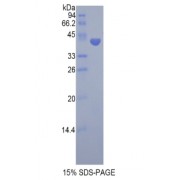 SDS-PAGE analysis of Pig FSHb Protein.