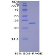 SDS-PAGE analysis of Human GbL Protein.