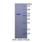 SDS-PAGE analysis of Human GRK5 Protein.