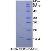 SDS-PAGE analysis of Human alpha Galactosidase Protein.