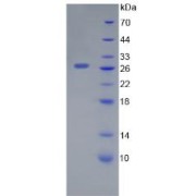 SDS-PAGE analysis of recombinant Human Galectin 12 Protein.