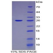 SDS-PAGE analysis of Human Gelsolin Protein.