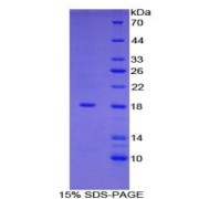 SDS-PAGE analysis of Human GMFg Protein.