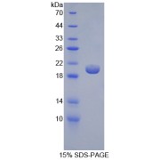 SDS-PAGE analysis of Human GKRP Protein.