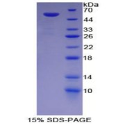 SDS-PAGE analysis of Rat G6PD Protein.