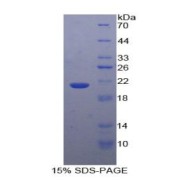 SDS-PAGE analysis of Human GaA Protein.