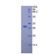 SDS-PAGE analysis of Rat Glucuronidase beta Protein.