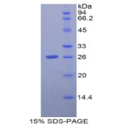 SDS-PAGE analysis of Human GCLC Protein.