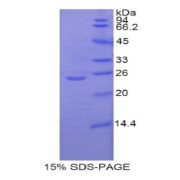 SDS-PAGE analysis of Rat GCLC Protein.