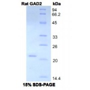 SDS-PAGE analysis of Rat GAD2 Protein.