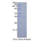 SDS-PAGE analysis of Rat GPX5 Protein.