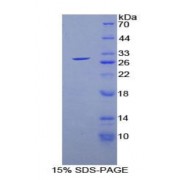 SDS-PAGE analysis of Human GSTa1 Protein.