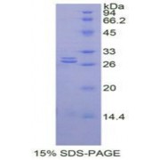 SDS-PAGE analysis of Rat GSTa1 Protein.