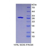 SDS-PAGE analysis of Mouse GSTk1 Protein.