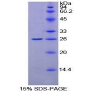 SDS-PAGE analysis of Rat GSTk1 Protein.