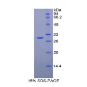 SDS-PAGE analysis of Human GSTm2 Protein.