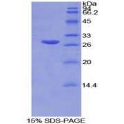 SDS-PAGE analysis of Mouse GSTm2 Protein.