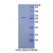 SDS-PAGE analysis of Human GSTm4 Protein.