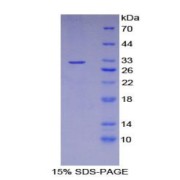 SDS-PAGE analysis of Human GSTo1 Protein.