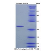SDS-PAGE analysis of recombinant Human GSTp Protein.