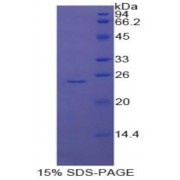 SDS-PAGE analysis of Cow GSTp Protein.