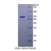 SDS-PAGE analysis of Human PYGB Protein.