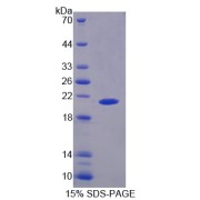 SDS-PAGE analysis of Rat PYGL Protein.