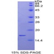 SDS-PAGE analysis of Rat GP1Bb Protein.