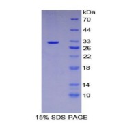 SDS-PAGE analysis of Mouse GP5 Protein.