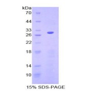 SDS-PAGE analysis of recombinant Human Granulin Protein.