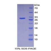 SDS-PAGE analysis of Mouse GAB1 Protein.