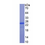 SDS-PAGE analysis of recombinant Rat Gremlin 1 Protein.