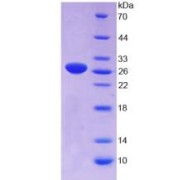 SDS-PAGE analysis of Rat GAS6 Protein.