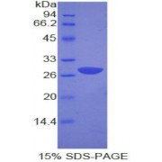 SDS-PAGE analysis of Human GRB2 Protein.