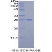 SDS-PAGE analysis of Mouse GRB7 Protein.