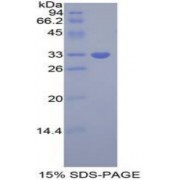 SDS-PAGE analysis of Human GRB7 Protein.