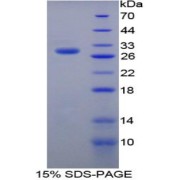 SDS-PAGE analysis of Rat GHR Protein.