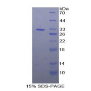 SDS-PAGE analysis of Human HSP90b1 Protein.