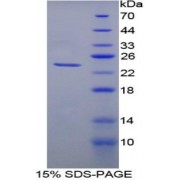 SDS-PAGE analysis of Pig Heme Oxygenase 1 Protein.