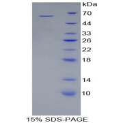 SDS-PAGE analysis of Pig Heme Oxygenase 1 Protein.