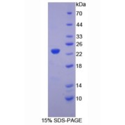 SDS-PAGE analysis of recombinant Chicken Hemoglobin beta Protein.