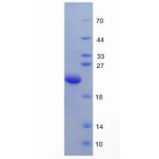 SDS-PAGE analysis of Human Hemojuvelin Protein.