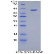 SDS-PAGE analysis of Human Hemojuvelin Protein.