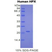 SDS-PAGE analysis of recombinant Human Hemopexin Protein.