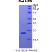 SDS-PAGE analysis of Rat Hemopexin Protein.