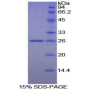 SDS-PAGE analysis of Human Heparanase Protein.