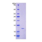 SDS-PAGE analysis of Human Pro-Hepcidin (Pro-HAMP) Protein.